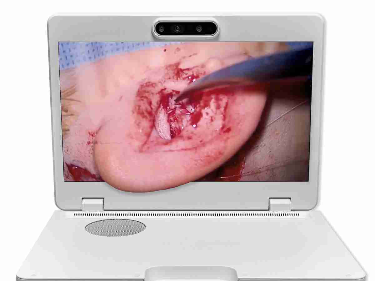 达擎之＂Heads-up 3D显微手术显示系统＂，，，，整合4K裸眼3D显示及眼球追踪系统，，，具备快速追踪人眼移动位置功能，，减轻医师长时间维持固定姿势的负担，，，，让医师能有更宽广清晰的3D立体视野及更舒适的姿势来执行手术。。。